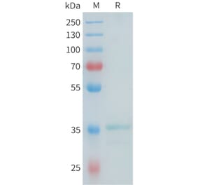 SDS-PAGE - Recombinant Mouse Glypican 3 Protein (N-terminal hFc Tag) (A332988) - Antibodies.com