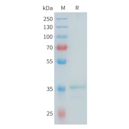SDS-PAGE - Recombinant Mouse Glypican 3 Protein (N-terminal hFc Tag) (A332988) - Antibodies.com