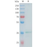SDS-PAGE - Recombinant Mouse Glypican 3 Protein (N-terminal hFc Tag) (A332988) - Antibodies.com