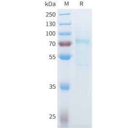 SDS-PAGE - Recombinant Mouse P-Cadherin Protein (C-terminal 10xHis Tag) (A332989) - Antibodies.com