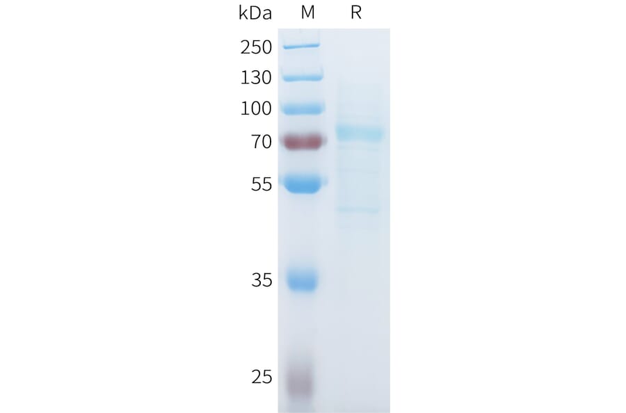 SDS-PAGE - Recombinant Mouse P-Cadherin Protein (C-terminal 10xHis Tag) (A332989) - Antibodies.com