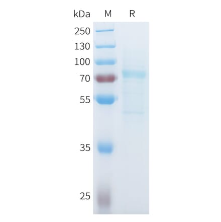 SDS-PAGE - Recombinant Mouse P-Cadherin Protein (C-terminal 10xHis Tag) (A332989) - Antibodies.com