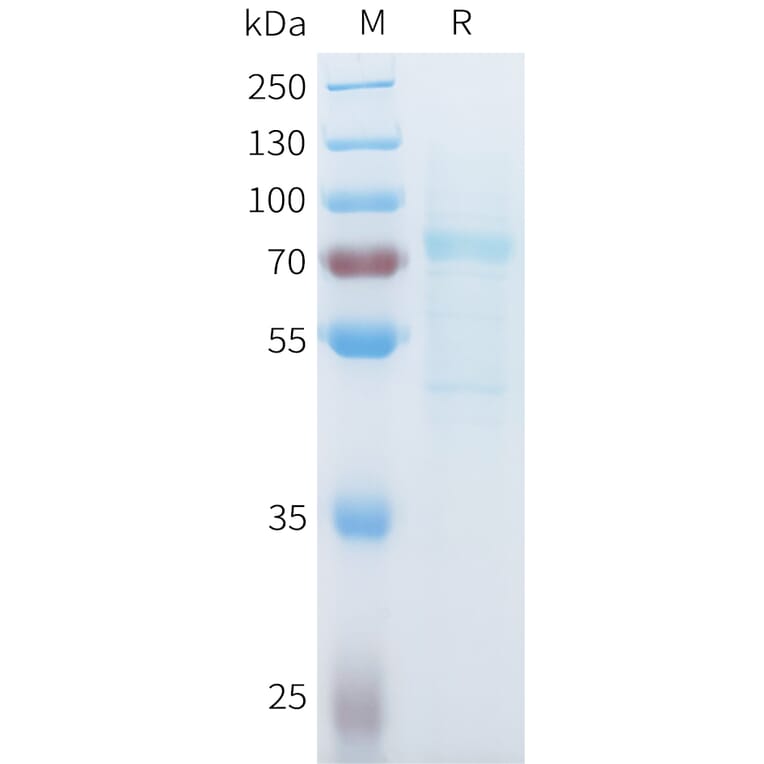 SDS-PAGE - Recombinant Mouse P-Cadherin Protein (C-terminal 10xHis Tag) (A332989) - Antibodies.com