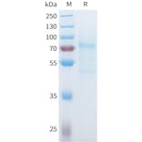 SDS-PAGE - Recombinant Mouse P-Cadherin Protein (C-terminal 10xHis Tag) (A332989) - Antibodies.com