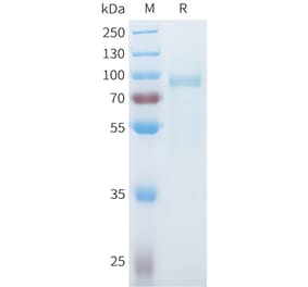 SDS-PAGE - Recombinant Mouse SLITRK6 Protein (C-terminal 10xHis Tag) (A332990) - Antibodies.com