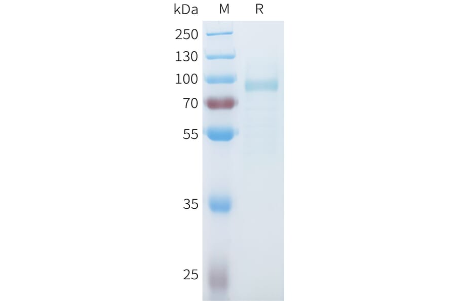 SDS-PAGE - Recombinant Mouse SLITRK6 Protein (C-terminal 10xHis Tag) (A332990) - Antibodies.com