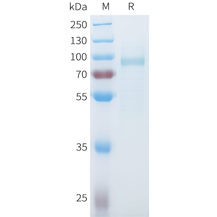SDS-PAGE - Recombinant Mouse SLITRK6 Protein (C-terminal 10xHis Tag) (A332990) - Antibodies.com