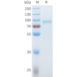 SDS-PAGE - Recombinant Mouse SLITRK6 Protein (C-terminal 10xHis Tag) (A332990) - Antibodies.com