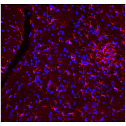 Immunofluorescence - Anti-Iba1 Antibody (A333275) - Antibodies.com