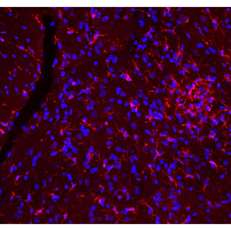 Immunofluorescence - Anti-Iba1 Antibody (A333275) - Antibodies.com