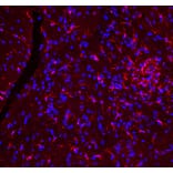 Immunofluorescence - Anti-Iba1 Antibody (A333275) - Antibodies.com