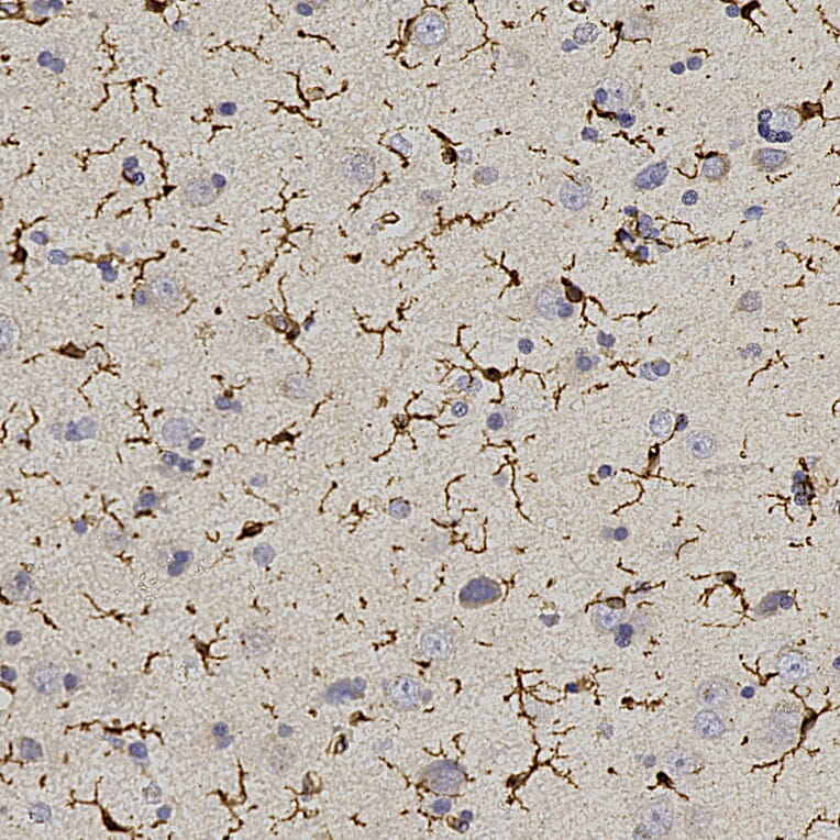 Immunohistochemistry - Anti-Iba1 Antibody (A333275) - Antibodies.com