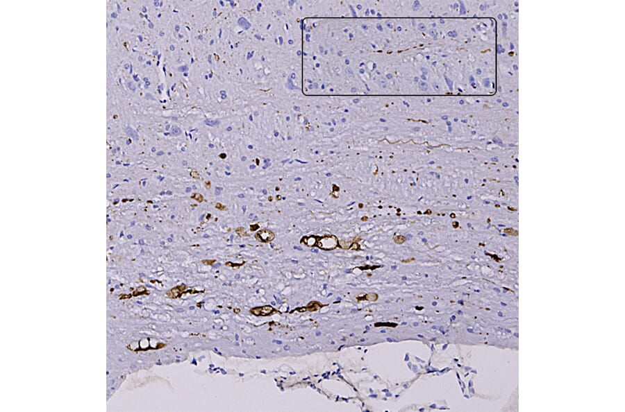 Immunohistochemistry - Anti-NF L Antibody (A333276) - Antibodies.com