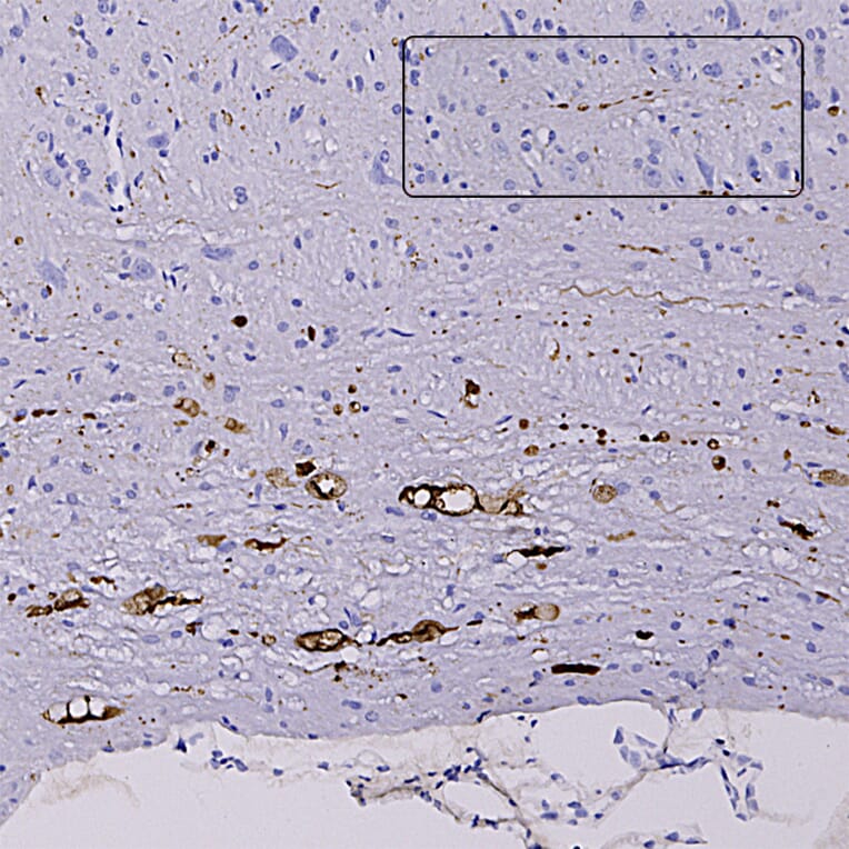 Immunohistochemistry - Anti-NF L Antibody (A333276) - Antibodies.com