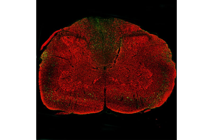 Immunofluorescence - Anti-NF L Antibody (A333277) - Antibodies.com