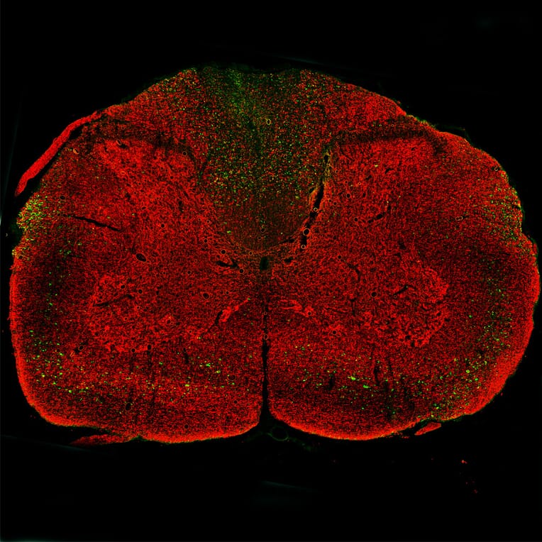 Immunofluorescence - Anti-NF L Antibody (A333277) - Antibodies.com