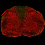 Immunofluorescence - Anti-NF L Antibody (A333277) - Antibodies.com