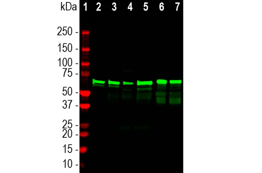 Western Blot - Anti-NF L Antibody (A333277) - Antibodies.com