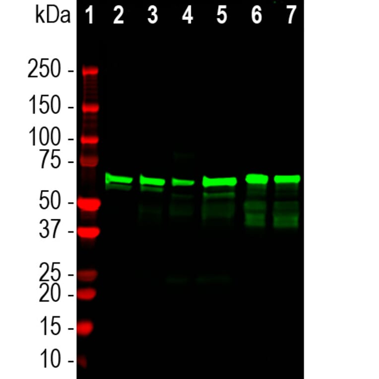 Western Blot - Anti-NF L Antibody (A333277) - Antibodies.com
