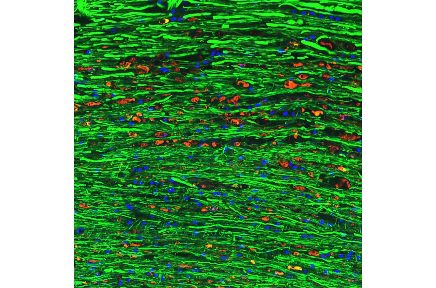Immunofluorescence - Anti-NF L Antibody (A333279) - Antibodies.com