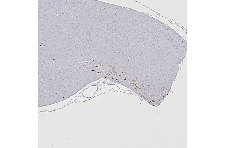 Immunohistochemistry - Anti-NF L Antibody (A333279) - Antibodies.com