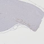 Immunohistochemistry - Anti-NF L Antibody (A333279) - Antibodies.com