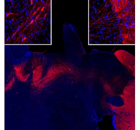 Immunofluorescence - Anti-Tyrosine Hydroxylase Antibody (A333280) - Antibodies.com