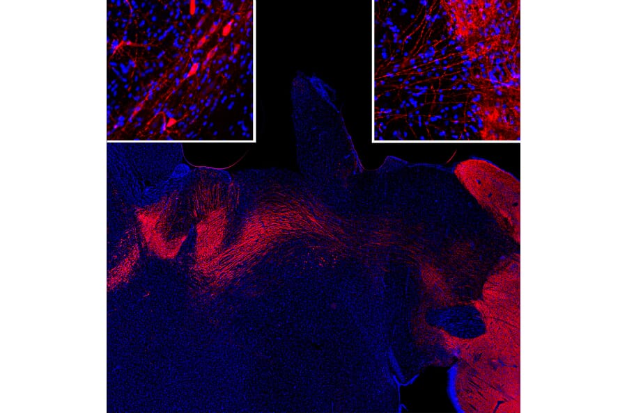 Immunofluorescence - Anti-Tyrosine Hydroxylase Antibody (A333280) - Antibodies.com