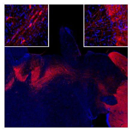 Immunofluorescence - Anti-Tyrosine Hydroxylase Antibody (A333280) - Antibodies.com