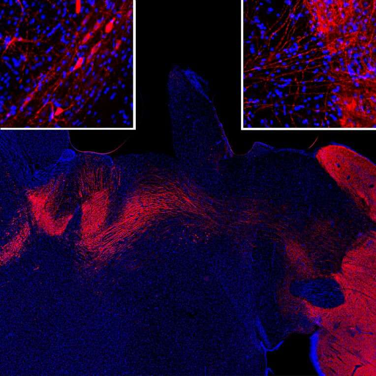 Immunofluorescence - Anti-Tyrosine Hydroxylase Antibody (A333280) - Antibodies.com