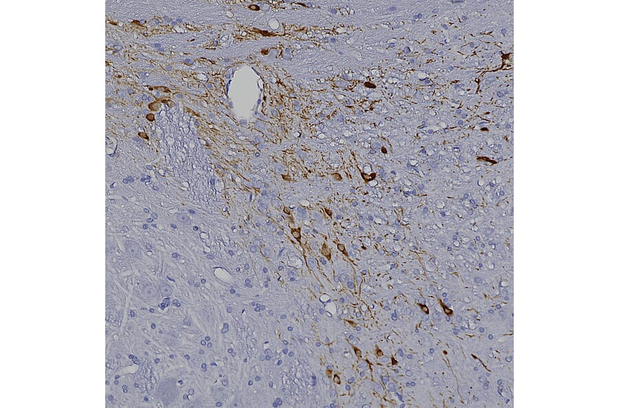 Immunohistochemistry - Anti-Tyrosine Hydroxylase Antibody (A333280) - Antibodies.com