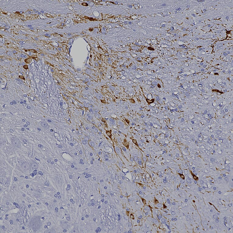 Immunohistochemistry - Anti-Tyrosine Hydroxylase Antibody (A333280) - Antibodies.com