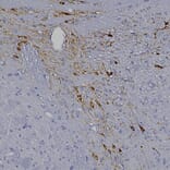 Immunohistochemistry - Anti-Tyrosine Hydroxylase Antibody (A333280) - Antibodies.com