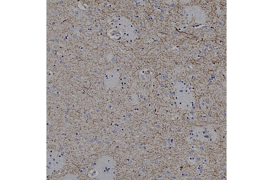 Immunohistochemistry - Anti-Tyrosine Hydroxylase Antibody (A333280) - Antibodies.com