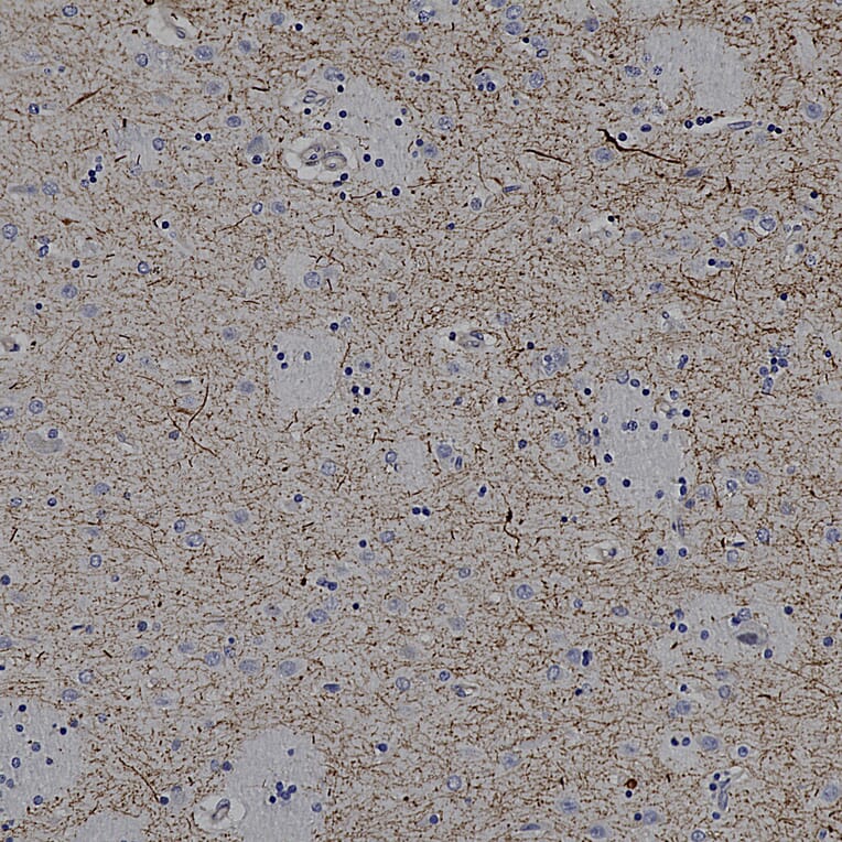 Immunohistochemistry - Anti-Tyrosine Hydroxylase Antibody (A333280) - Antibodies.com