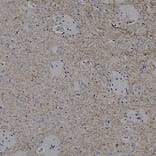 Immunohistochemistry - Anti-Tyrosine Hydroxylase Antibody (A333280) - Antibodies.com