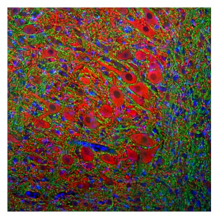 Immunofluorescence - Anti-MAP2 Antibody (A333281) - Antibodies.com