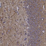 Immunohistochemistry - Anti-MAP2 Antibody (A333281) - Antibodies.com