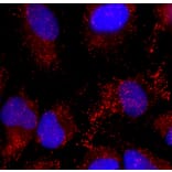 Immunofluorescence - Anti-Catalase Antibody (A333282) - Antibodies.com