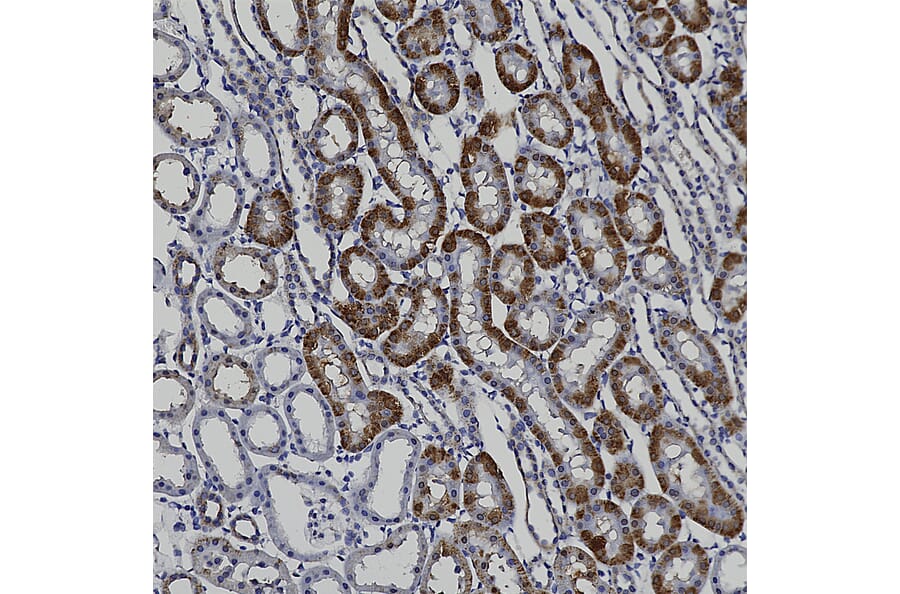 Immunohistochemistry - Anti-Catalase Antibody (A333282) - Antibodies.com