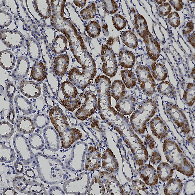 Immunohistochemistry - Anti-Catalase Antibody (A333282) - Antibodies.com