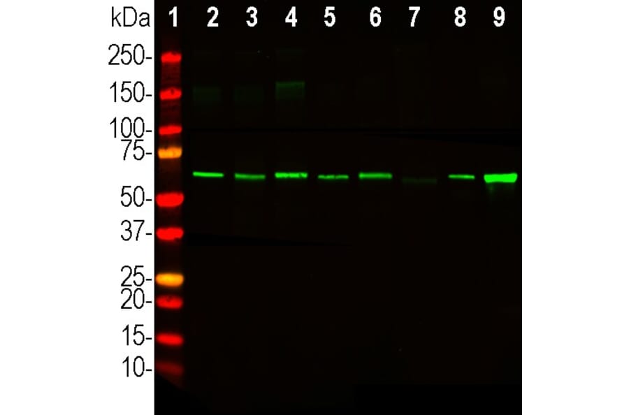 Western Blot - Anti-Catalase Antibody (A333282) - Antibodies.com