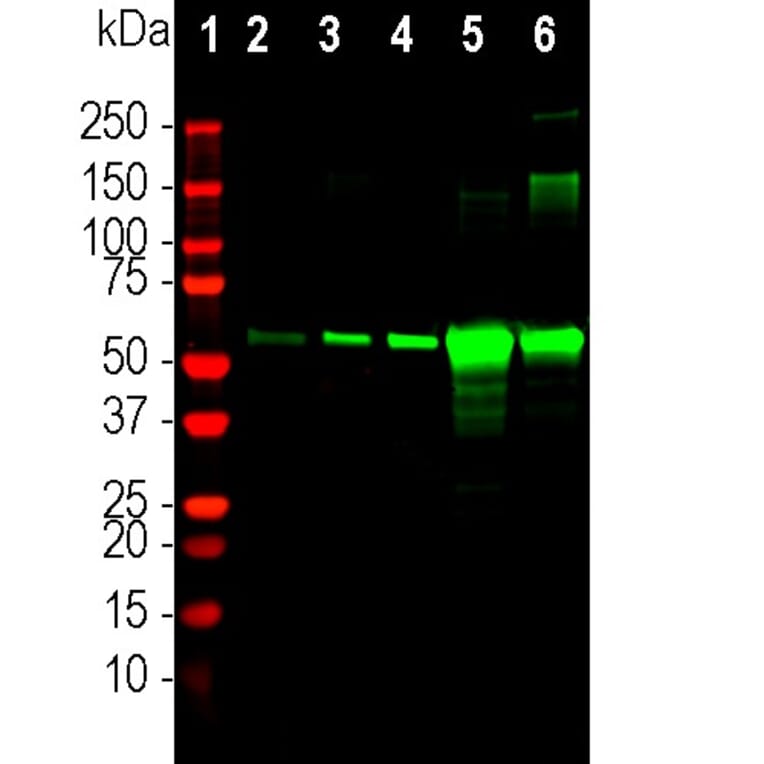 Western Blot - Anti-Catalase Antibody (A333282) - Antibodies.com
