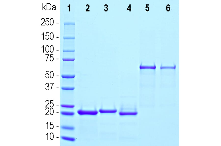 SDS-PAGE - Recombinant Human gamma Synuclein Protein (A333283) - Antibodies.com