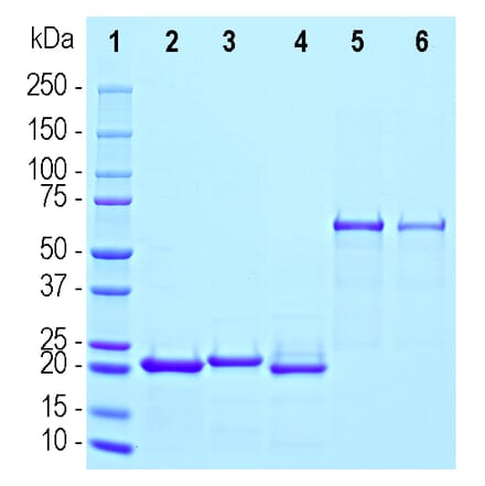 SDS-PAGE - Recombinant Human gamma Synuclein Protein (A333283) - Antibodies.com