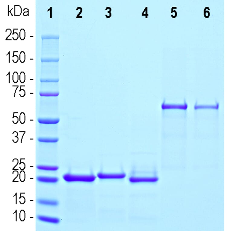 SDS-PAGE - Recombinant Human gamma Synuclein Protein (A333283) - Antibodies.com