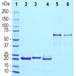 SDS-PAGE - Recombinant Human gamma Synuclein Protein (A333283) - Antibodies.com