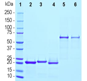 SDS-PAGE - Recombinant Human beta Synuclein Protein (A333285) - Antibodies.com