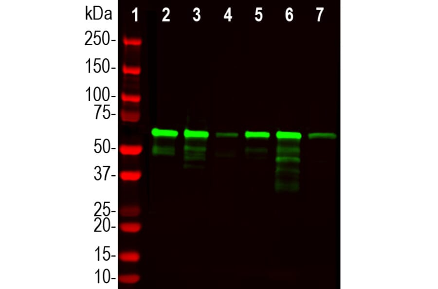 Western Blot - Anti-PLS1 Antibody (A333287) - Antibodies.com