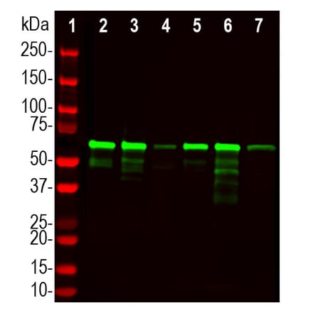Western Blot - Anti-PLS1 Antibody (A333287) - Antibodies.com